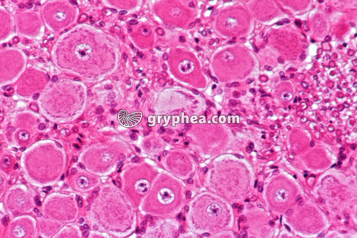 Ganglion Rachidien x100 - gryphea.com